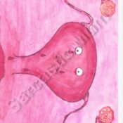 Sad Uterus